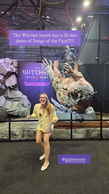 Sjokz page leaked private photo uncensored HD quality